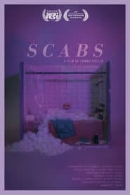 Scabs